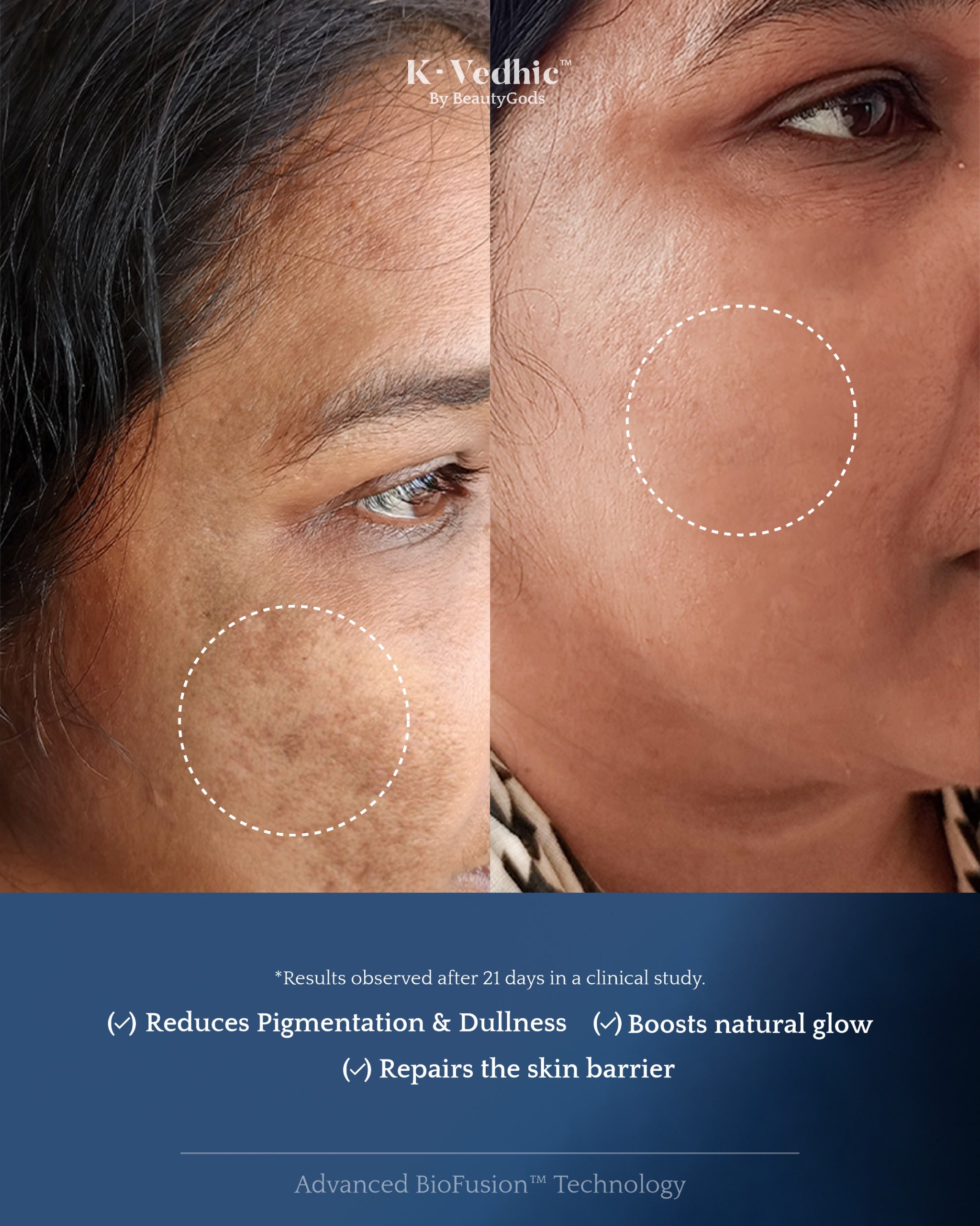 VISIBLE RESULTS IN 21 DAYS*