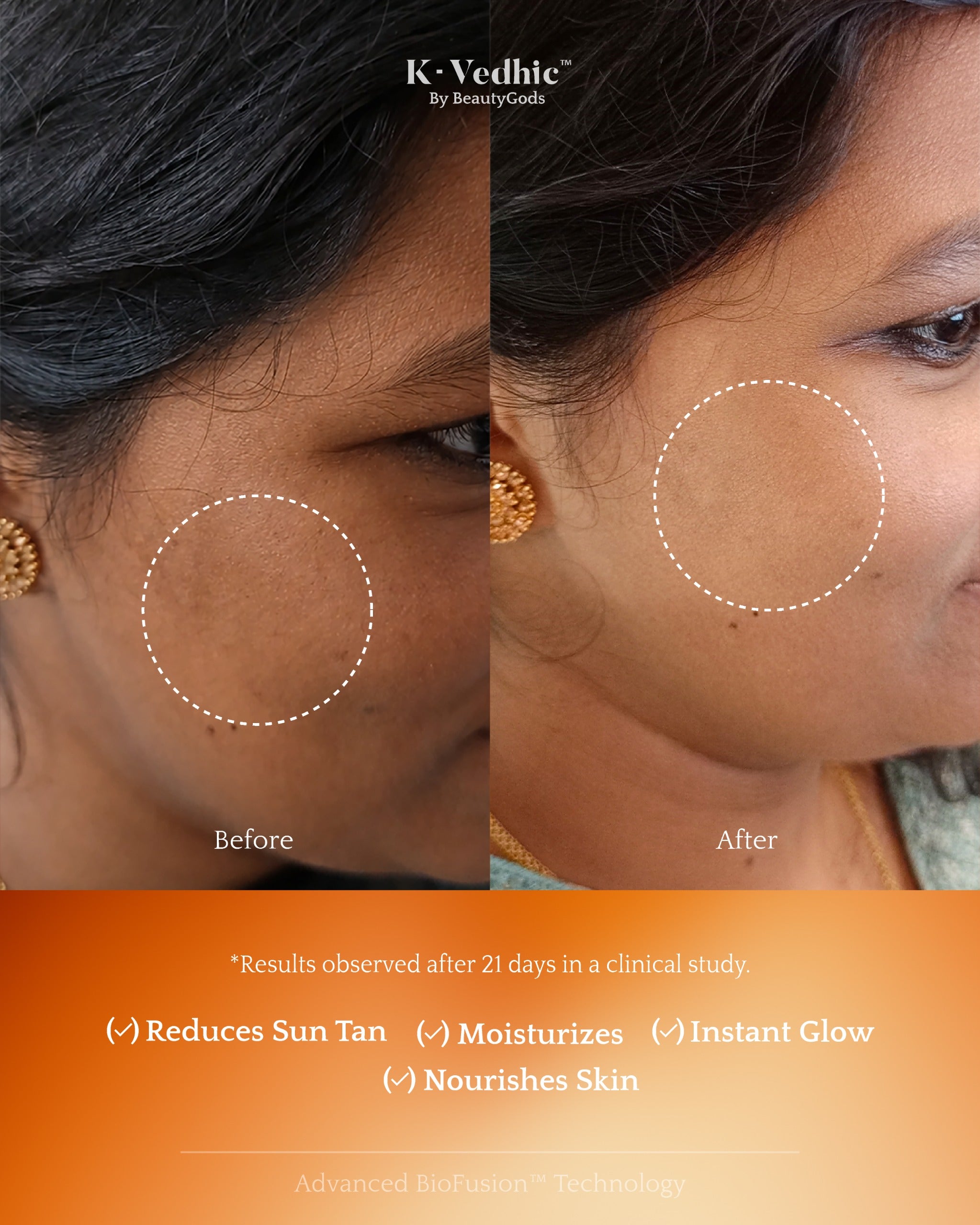 VISIBLE RESULTS IN 21 DAYS*